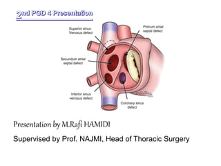 Presentation by M.Rafi HAMIDI
Supervised by Prof. NAJMI, Head of Thoracic Surgery
 