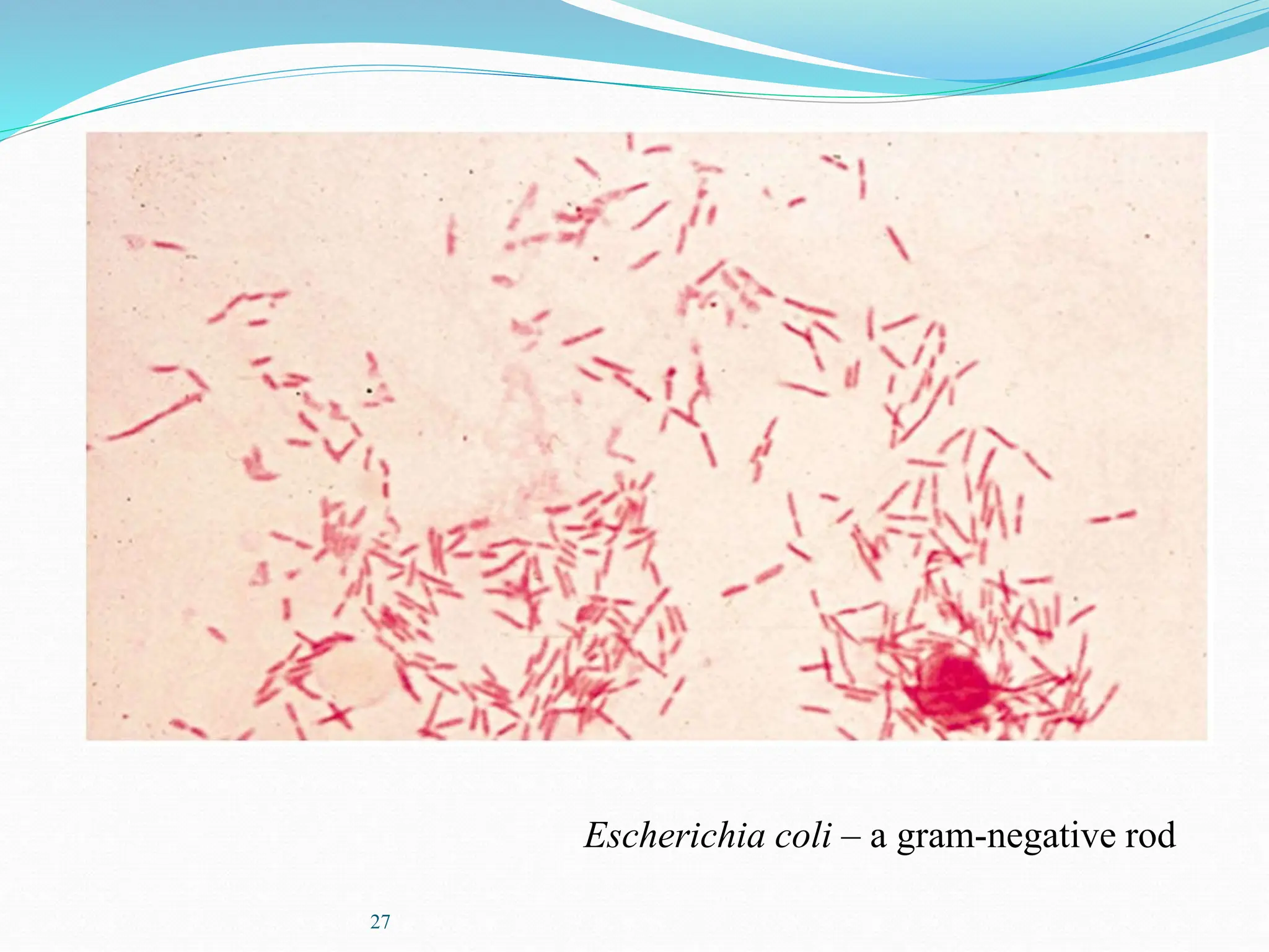 27
Escherichia coli – a gram-negative rod
 
