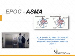 EPOC - ASMA
Lic.. NOELIA LILIA LIMAYLLA LA TORRE
Fisioterapeuta Cardiorrespiratorio
Hospital II Clínica Geriátrica San Isidro
Labrador
 