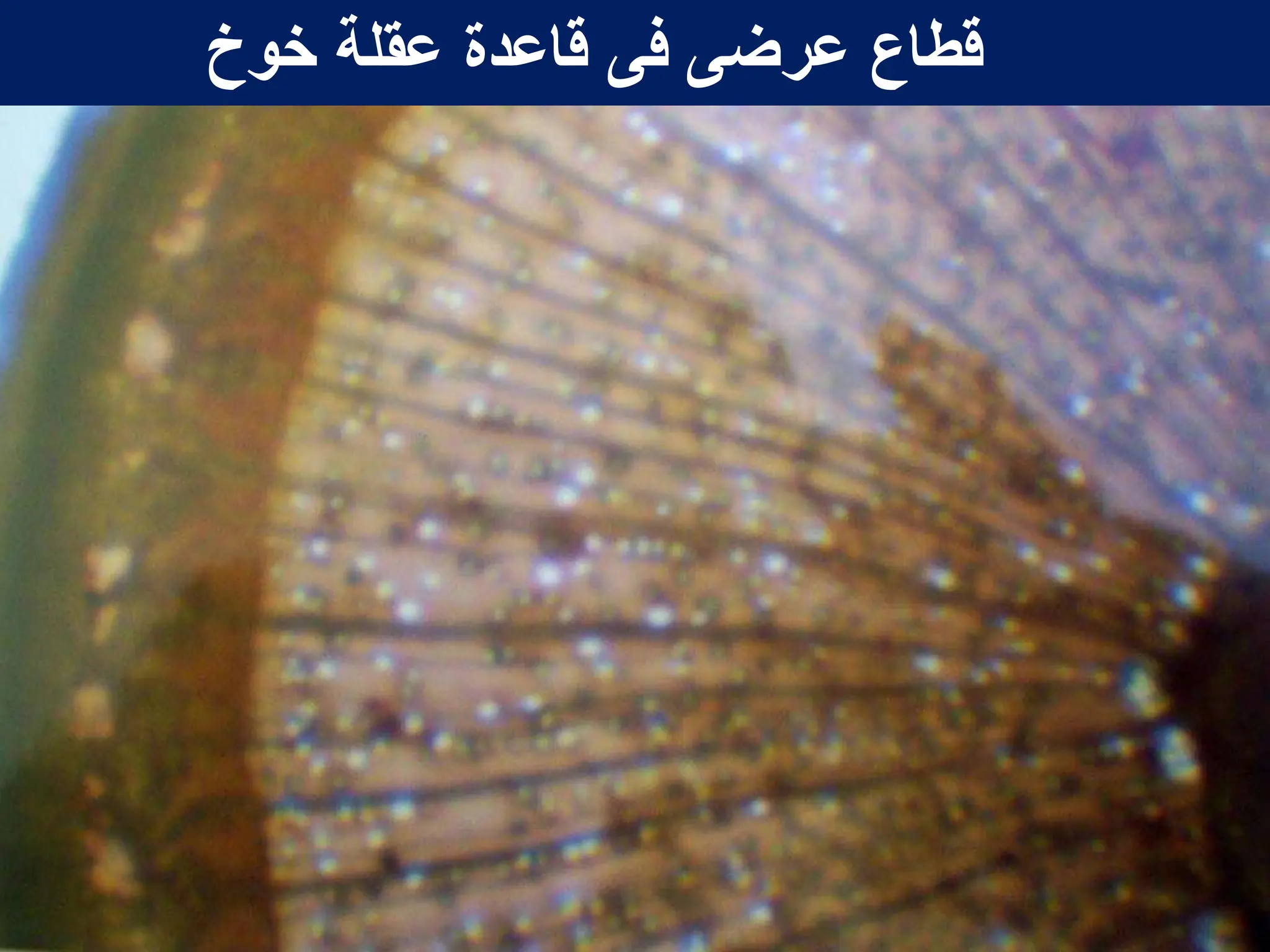 ‫خوخ‬ ‫عقلة‬ ‫قاعدة‬ ‫فى‬ ‫عرضى‬ ‫قطاع‬
 