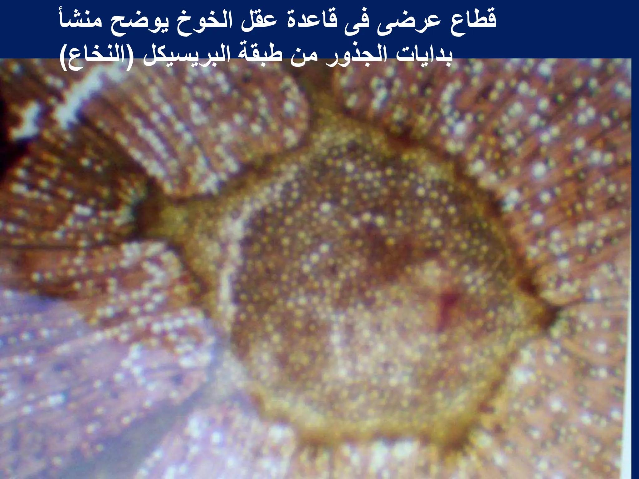 ‫منشأ‬ ‫ٌوضح‬ ‫الخوخ‬ ‫عقل‬ ‫قاعدة‬ ‫فى‬ ‫عرضى‬ ‫قطاع‬
‫البرٌسٌكل‬ ‫طبقة‬ ‫من‬ ‫الجذور‬ ‫بداٌات‬
(
‫النخاع‬
)
 