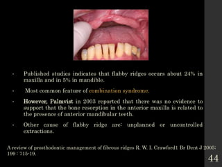 Flaring Ridge Defect 2. EVALUATION OF IMPRESSION TECHNIQUE IN COMPLETE DENTURE.pptx