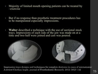 2. EVALUATION OF IMPRESSION TECHNIQUE IN COMPLETE DENTURE.pptx
