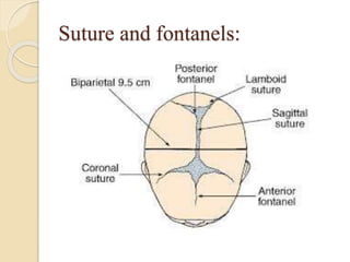 Suture and fontanels:
 