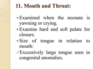 11. Mouth and Throat:
 Examined when the neonate is
yawning or crying.
 Examine hard and soft palate for
closure.
 Size of tongue in relation to
mouth:
Excessively large tongue seen in
congenital anomalies.
 