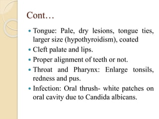 Cont…
 Tongue: Pale, dry lesions, tongue ties,
larger size (hypothyroidism), coated
 Cleft palate and lips.
 Proper alignment of teeth or not.
 Throat and Pharynx: Enlarge tonsils,
redness and pus.
 Infection: Oral thrush- white patches on
oral cavity due to Candida albicans.
 