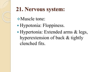21. Nervous system:
Muscle tone:
 Hypotonia: Floppiness.
 Hypertonia: Extended arms & legs,
hyperextension of back & tightly
clenched fits.
 