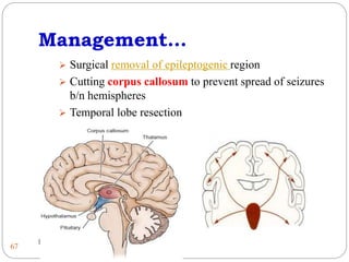 2-neurologic-disorder-health-assessment-ppt