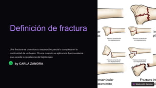 Definición de fractura
Una fractura es una rotura o separación parcial o completa en la
continuidad de un hueso. Ocurre cuando se aplica una fuerza externa
que excede la resistencia del tejido óseo.
Ca by CARLA ZAMORA
 