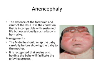 Brainless Child PPT ON Congenital anomalies.pptx