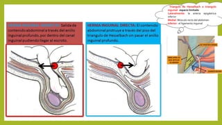 Triangulo de Hesselbach o triangulo
inguinal: espacio limitado
Lateralmente: la arteria epigástrica
inferior
Medial: Músculo recto del abdomen
inferior: el ligamento inguinal
 