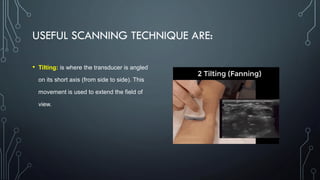 USEFUL SCANNING TECHNIQUE ARE:
• Tilting: is where the transducer is angled
on its short axis (from side to side). This
movement is used to extend the field of
view.
 