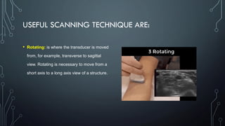 USEFUL SCANNING TECHNIQUE ARE:
• Rotating: is where the transducer is moved
from, for example, transverse to sagittal
view. Rotating is necessary to move from a
short axis to a long axis view of a structure.
 