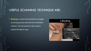 USEFUL SCANNING TECHNIQUE ARE:
• Rocking: is where the transducer is angled
on its long axis (to and from the orientation
marker). This movement is also used to
extend the field of view.
 