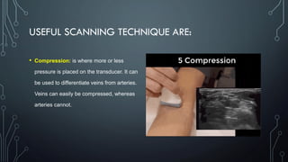 USEFUL SCANNING TECHNIQUE ARE:
• Compression: is where more or less
pressure is placed on the transducer. It can
be used to differentiate veins from arteries.
Veins can easily be compressed, whereas
arteries cannot.
 