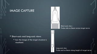 IMAGE CAPTURE
• Short-axis and long-axis views
• how the image of the target structure is
visualized.
Short-axis view :
Probe side on Beam across target nerve
Long-axis view
Probe end on Beam along length of target nerve
 