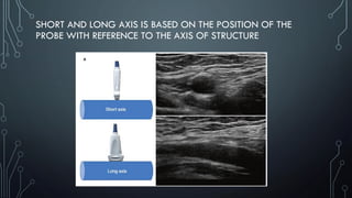 SHORT AND LONG AXIS IS BASED ON THE POSITION OF THE
PROBE WITH REFERENCE TO THE AXIS OF STRUCTURE
 