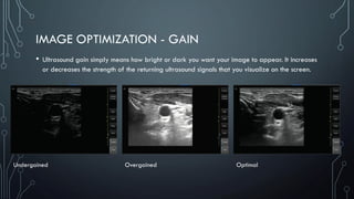 IMAGE OPTIMIZATION - GAIN
• Ultrasound gain simply means how bright or dark you want your image to appear. It increases
or decreases the strength of the returning ultrasound signals that you visualize on the screen.
Undergained Overgained Optimal
 
