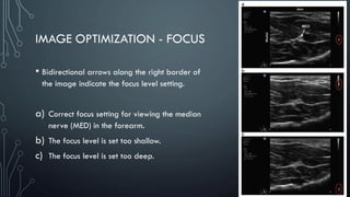IMAGE OPTIMIZATION - FOCUS
• Bidirectional arrows along the right border of
the image indicate the focus level setting.
a) Correct focus setting for viewing the median
nerve (MED) in the forearm.
b) The focus level is set too shallow.
c) The focus level is set too deep.
 