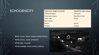 ECHOGENICITY
• Black arrow, blood vessel (radial artery);
• White arrow, nerve (median);
• White star, muscle;
• White triangle, bone cortex (radius).
 