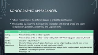 SONOGRAPHIC APPEARANCES
• Pattern recognition of the different tissues is critical to identification.
• This is aided by observing their real-time interaction with the US probe and beam
(compression, pulsation, anisotropy, and Doppler shift).
Tissue US appearance
Artery Anechoic (black circles or tubes)—pulsatile
Vein Anechoic (black circles or tubes)—compressible, dilate with Valsalva (jugular, subclavian, femoral)
Tendon
Fibrillar
appearance
Long axis—tubular structure
Internal architecture, loosely packed continuous blurred bright lines (hyperechoic), pale surface
Short axis—circular structure with pale halo (tendon sheath)
Internal architecture hyperechoic (semi-bright) dots (tendon fibrils) loosely packed, within hypoechoic
(darkened) surroundings—‘granular appearance’
Anisotropic ++
 