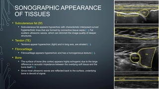 SONOGRAPHIC APPEARANCE
OF TISSUES
• Subcutaneous fat (Sf)
• Subcutaneous fat appears hypoechoic with characteristic interposed curved
hyperechoic lines that are formed by connective tissue septa (E). Fat
scatters ultrasonic waves, which can diminish the image quality of deeper
structures.
• Tendon (TE)
• Tendons appear hyperechoic (light) and in long axis, are striated (G).
• Fibrocartilage
• Fibrocartilage appears hyperechoic and has a homogeneous texture (D).
• Bone
• The surface of bone (the cortex) appears highly echogenic due to the large
difference in acoustic impedance between the overlying soft tissue and the
bone itself (D).
• Since most ultrasonic waves are reflected back to the surface, underlying
bone is devoid of signal.
 