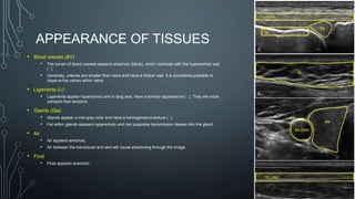 APPEARANCE OF TISSUES
• Blood vessels (BV)
• The lumen of blood vessels appears anechoic (black), which contrasts with the hyperechoic wall
(F).
• Generally, arteries are smaller than veins and have a thicker wall. It is sometimes possible to
observe the valves within veins.
• Ligaments (Li)
• Ligaments appear hyperechoic and in long axis, have a laminar appearance (D). They are more
compact than tendons.
• Glands (Gla)
• Glands appear a mid-gray color and have a homogeneous texture (F).
• Fat within glands appears hyperechoic and can suppress transmission deeper into the gland.
• Air
• Air appears anechoic.
• Air between the transducer and skin will cause shadowing through the image.
• Fluid
• Fluid appears anechoic.
 