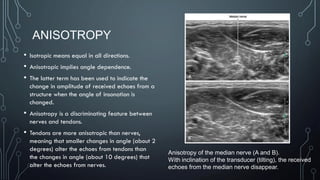 ANISOTROPY
• Isotropic means equal in all directions.
• Anisotropic implies angle dependence.
• The latter term has been used to indicate the
change in amplitude of received echoes from a
structure when the angle of insonation is
changed.
• Anisotropy is a discriminating feature between
nerves and tendons.
• Tendons are more anisotropic than nerves,
meaning that smaller changes in angle (about 2
degrees) alter the echoes from tendons than
the changes in angle (about 10 degrees) that
alter the echoes from nerves.
Anisotropy of the median nerve (A and B).
With inclination of the transducer (tilting), the received
echoes from the median nerve disappear.
 