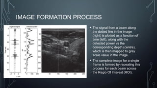 IMAGE FORMATION PROCESS
• The signal from a beam along
the dotted line in the image
(right) is plotted as a function of
time (left), along with the
detected power vs the
corresponding depth (centre),
which is then mapped to grey
scale value in the image.
• The complete image for a single
frame is formed by repeating this
process for each beam across
the Regio Of Interest (ROI).
 