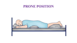 PRONE POSITION
 