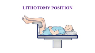 LITHOTOMY POSITION
 
