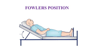 FOWLERS POSITION
 