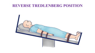 REVERSE TREDLENBERG POSITION
 