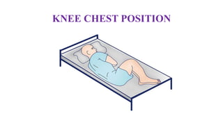 KNEE CHEST POSITION
 