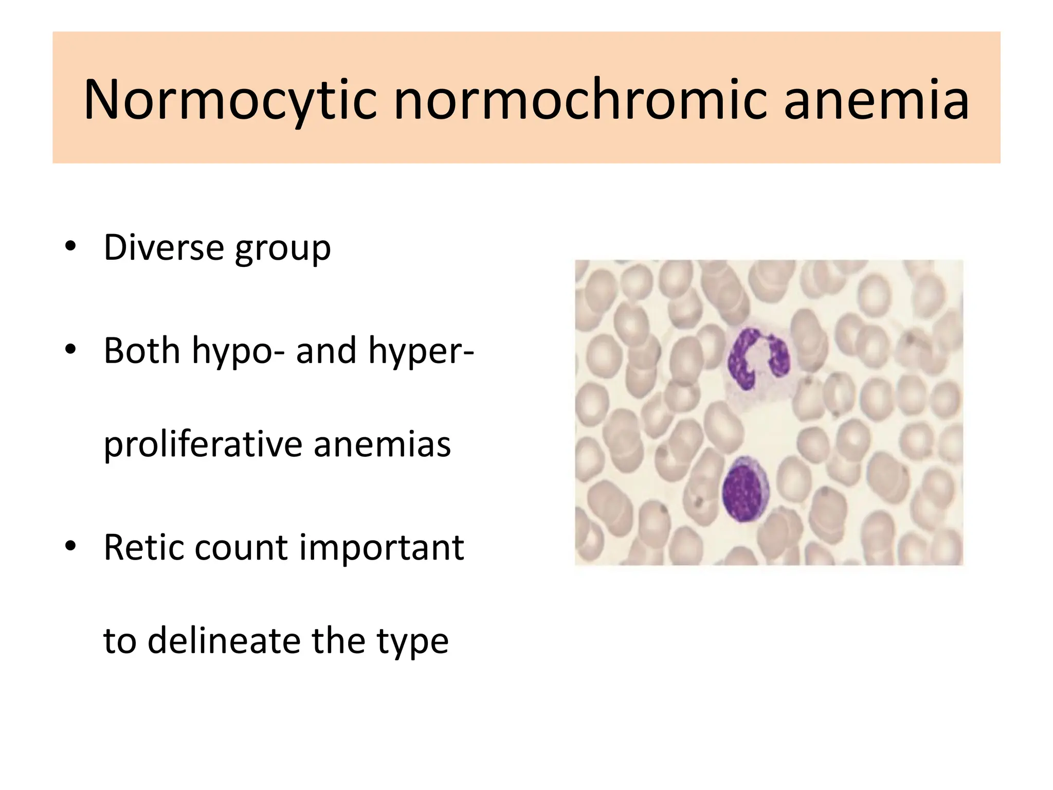 Peripheral blood smeared examination test | PDF