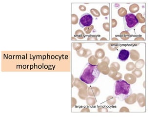 Peripheral blood smeared examination test | PDF