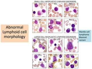 Peripheral blood smeared examination test | PDF