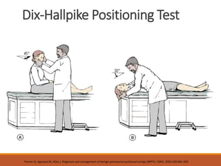 Dix-Hallpike Positioning Test
Parnes LS, Agrawal SK, Atlas J. Diagnosis and management of benign paroxysmal positional vertigo (BPPV). CMAJ. 2003:169:681-693
 