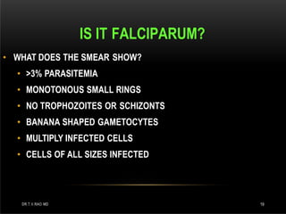 IS IT FALCIPARUM?
DR.T.V.RAO MD 19
• WHAT DOES THE SMEAR SHOW?
• >3% PARASITEMIA
• MONOTONOUS SMALL RINGS
• NO TROPHOZOITES OR SCHIZONTS
• BANANA SHAPED GAMETOCYTES
• MULTIPLY INFECTED CELLS
• CELLS OF ALL SIZES INFECTED
 