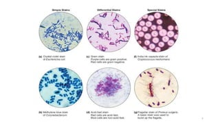 Identification of bacteria using staining techniques | PPTX