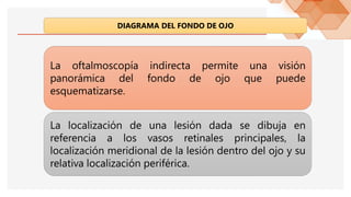 DIAGRAMA DEL FONDO DE OJO
La oftalmoscopía indirecta permite una visión
panorámica del fondo de ojo que puede
esquematizarse.
La localización de una lesión dada se dibuja en
referencia a los vasos retinales principales, la
localización meridional de la lesión dentro del ojo y su
relativa localización periférica.
 