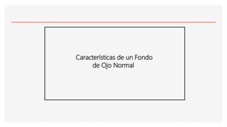 Características de un Fondo
de Ojo Normal
 