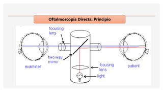 Oftalmoscopía Directa: Principio
 