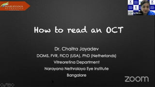 2.- OFTALMOSCOPÍA.pdf123456890123456677