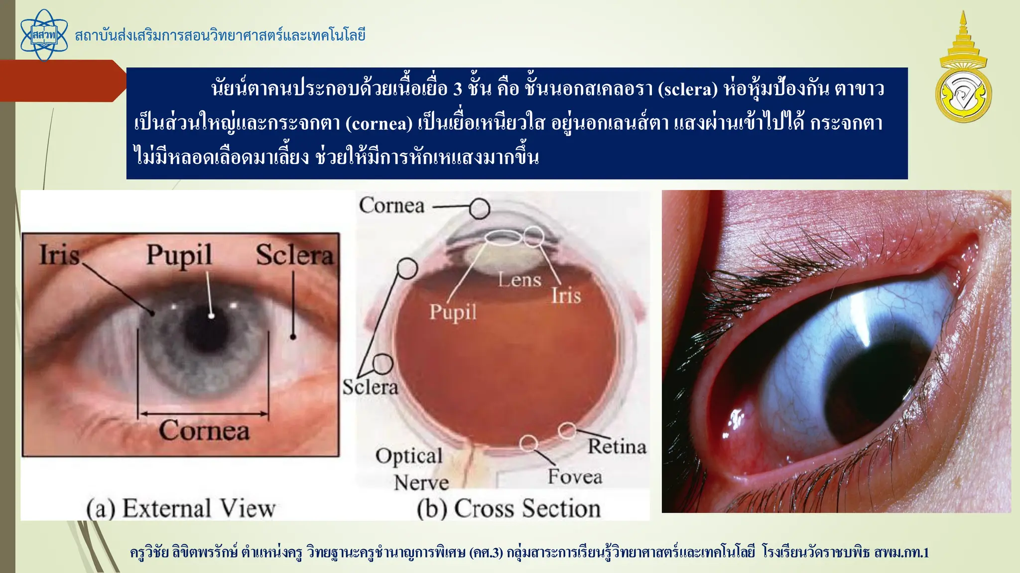 สถาบันส่งเสริมการสอนวิทยาศาสตร์และเทคโนโลยี
ครูวิชัยลิขิตพรรักษ์ ตาแหน่งครู วิทยฐานะครูชานาญการพิเศษ(คศ.3)กลุ่มสาระการเรียนรู้วิทยาศาสตร์และเทคโนโลยี โรงเรียนวัดราชบพิธ สพม.กท.1
นัยน์ตาคนประกอบด้วยเนื้อเยื่อ 3 ชั้น คือ ชั้นนอกสเคลอรา (sclera) ห่อหุ้มป้องกัน ตาขาว
เป็นส่วนใหญ่และกระจกตา (cornea) เป็นเยื่อเหนียวใส อยู่นอกเลนส์ตา แสงผ่านเข้าไปได้ กระจกตา
ไม่มีหลอดเลือดมาเลี้ยง ช่วยให้มีการหักเหแสงมากขึ้น
 