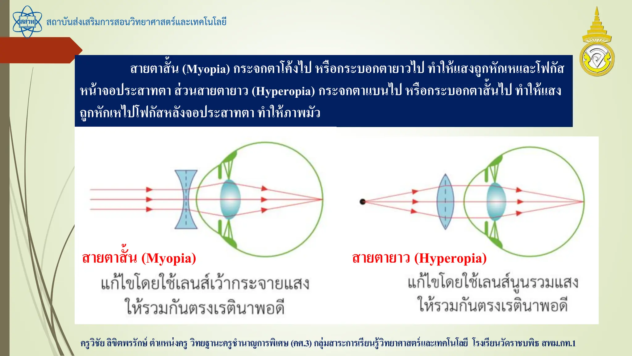 สถาบันส่งเสริมการสอนวิทยาศาสตร์และเทคโนโลยี
ครูวิชัยลิขิตพรรักษ์ ตาแหน่งครู วิทยฐานะครูชานาญการพิเศษ(คศ.3)กลุ่มสาระการเรียนรู้วิทยาศาสตร์และเทคโนโลยี โรงเรียนวัดราชบพิธ สพม.กท.1
สายตาสั้น (Myopia) กระจกตาโค้งไป หรือกระบอกตายาวไปทาให้แสงถูกหักเหและโฟกัส
หน้าจอประสาทตา ส่วนสายตายาว (Hyperopia) กระจกตาแบนไปหรือกระบอกตาสั้นไปทาให้แสง
ถูกหักเหไปโฟกัสหลังจอประสาทตาทาให้ภาพมัว
สายตาสั้น (Myopia) สายตายาว (Hyperopia)
 