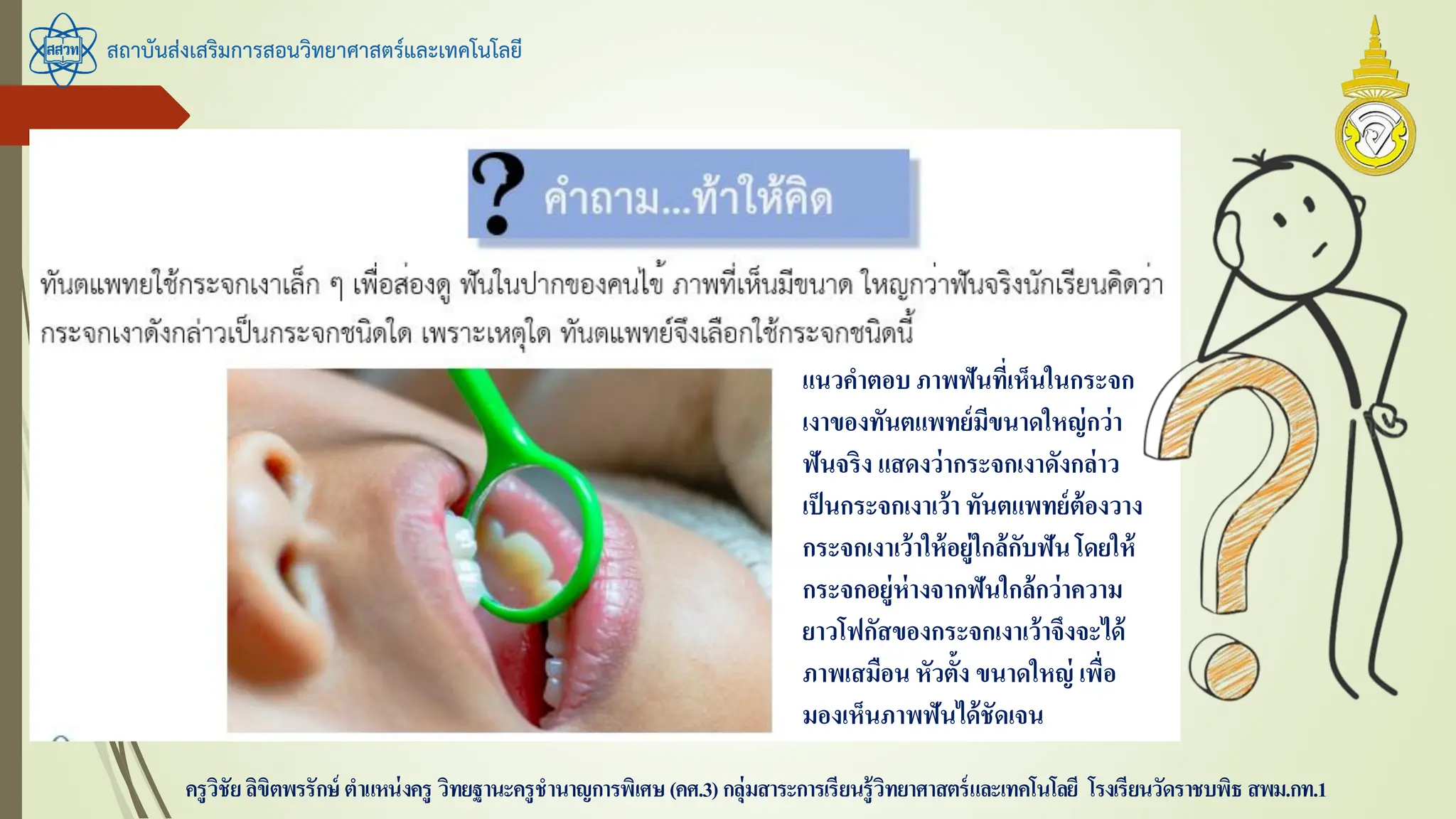 สถาบันส่งเสริมการสอนวิทยาศาสตร์และเทคโนโลยี
ครูวิชัยลิขิตพรรักษ์ ตาแหน่งครู วิทยฐานะครูชานาญการพิเศษ(คศ.3)กลุ่มสาระการเรียนรู้วิทยาศาสตร์และเทคโนโลยี โรงเรียนวัดราชบพิธ สพม.กท.1
แนวคาตอบ ภาพฟันที่เห็นในกระจก
เงาของทันตแพทย์มีขนาดใหญ่กว่า
ฟันจริง แสดงว่ากระจกเงาดังกล่าว
เป็นกระจกเงาเว้า ทันตแพทย์ต้องวาง
กระจกเงาเว้าให้อยู่ใกล้กับฟันโดยให้
กระจกอยู่ห่างจากฟันใกล้กว่าความ
ยาวโฟกัสของกระจกเงาเว้าจึงจะได้
ภาพเสมือน หัวตั้ง ขนาดใหญ่ เพื่อ
มองเห็นภาพฟันได้ชัดเจน
 