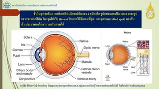 สถาบันส่งเสริมการสอนวิทยาศาสตร์และเทคโนโลยี
ครูวิชัยลิขิตพรรักษ์ ตาแหน่งครู วิทยฐานะครูชานาญการพิเศษ(คศ.3)กลุ่มสาระการเรียนรู้วิทยาศาสตร์และเทคโนโลยี โรงเรียนวัดราชบพิธ สพม.กท.1
ชั้นในสุดจอรับภาพหรือเรติน่า มีเซลล์รับแสง 2 ชนิด คือ รูปแท่งบอกปริมาณแสงและรูป
กรวยจะบอกสีสัน โดยจุดโฟเวีย (fovea) รับภาพได้ชัดเจนที่สุด และจุดบอด (blindspot) ตรงกับ
เส้นประสาทตาไม่สามารถรับภาพได้
 