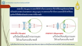 สถาบันส่งเสริมการสอนวิทยาศาสตร์และเทคโนโลยี
ครูวิชัยลิขิตพรรักษ์ ตาแหน่งครู วิทยฐานะครูชานาญการพิเศษ(คศ.3)กลุ่มสาระการเรียนรู้วิทยาศาสตร์และเทคโนโลยี โรงเรียนวัดราชบพิธ สพม.กท.1
สายตาสั้น (Myopia) กระจกตาโค้งไป หรือกระบอกตายาวไปทาให้แสงถูกหักเหและโฟกัส
หน้าจอประสาทตา ส่วนสายตายาว (Hyperopia) กระจกตาแบนไปหรือกระบอกตาสั้นไปทาให้แสง
ถูกหักเหไปโฟกัสหลังจอประสาทตาทาให้ภาพมัว
สายตาสั้น (Myopia) สายตายาว (Hyperopia)
 