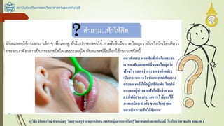 สถาบันส่งเสริมการสอนวิทยาศาสตร์และเทคโนโลยี
ครูวิชัยลิขิตพรรักษ์ ตาแหน่งครู วิทยฐานะครูชานาญการพิเศษ(คศ.3)กลุ่มสาระการเรียนรู้วิทยาศาสตร์และเทคโนโลยี โรงเรียนวัดราชบพิธ สพม.กท.1
แนวคาตอบ ภาพฟันที่เห็นในกระจก
เงาของทันตแพทย์มีขนาดใหญ่กว่า
ฟันจริง แสดงว่ากระจกเงาดังกล่าว
เป็นกระจกเงาเว้า ทันตแพทย์ต้องวาง
กระจกเงาเว้าให้อยู่ใกล้กับฟันโดยให้
กระจกอยู่ห่างจากฟันใกล้กว่าความ
ยาวโฟกัสของกระจกเงาเว้าจึงจะได้
ภาพเสมือน หัวตั้ง ขนาดใหญ่ เพื่อ
มองเห็นภาพฟันได้ชัดเจน
 